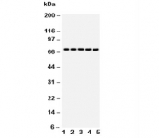 Western blot testing of HSP70 antibody and Lane 1:  293T;  2: HeLa;  3: A549;  4: A431;  5: PANC cell lysate. Expected molecular weight ~70 kDa.