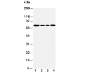 Western blot testing of BiP antibody and Lane 1:  rat testis;  2: A549;  3: MCF-7;  4: HeLa cell lysate. Predicted molecular weight: ~73 kDa, but routinely observed at 70-78 kDa.