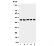 Western blot testing of HYAL2 antibody and Lane 1:  HeLa;  2: SMMC-7721;  3: COLO320;  4: MCF-7;  5: HT1080 cell lysate