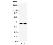 Western blot testing of IRF2 antibody and Lane 1:  HeLa;  2: MCF-7 cell lysate. Estimated molecular weight: ~39kDa but routinely observed at 39-50kDa.
