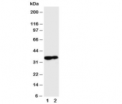 Western blot testing of Kallikrein 9 antibody and Lane 1:  MCF-7;  2: A431 cell lysate