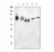 Western blot testing of 1) human HepG2, 2) human Jurkat, 3) human HeLa, 4) mouse brain and 5) mouse lung tissue lysate with LAMP1 antibody.  This heavily glycosylated protein of 417 amino acids can be visualized at up to 140 kDa.