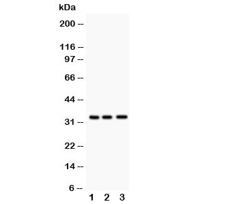 Western blot testing of MPG antibody and Lane 1: rat liver; 2: human HeLa; 3: (h) Jurkat. Predicted size: 33KD