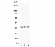 Western blot testing of MPG antibody and Lane 1:  rat liver;  2: human HeLa;  3: (h) Jurkat.  Predicted molecular weight: ~33kDa.