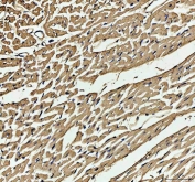 IHC staining of FFPE rat heart tissue with Myoglobin antibody. HIER: boil tissue sections in pH8 EDTA for 20 min and allow to cool before testing.