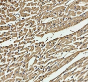 IHC-P: Myoglobin antibody testing of rat skeletal muscle tissue