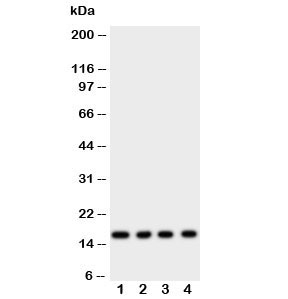 Western blot testing of Myoglobin antibody and rat samples 1: skeletal muscle; 2: heart; 3: liver; 4: intestine tissue lysate. Predicted size: 17KD~