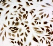ICC testing of NM23 antibody and HeLa cells.