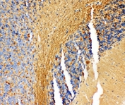 IHC-P: NM23 antibody testing of FFPE rat cerebellum tissue. HIER: steam section in pH6 citrate buffer for 20 min and allow to cool prior to staining.