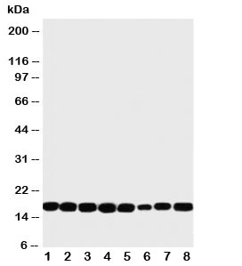 Western blot testing of NM23 antibody and rat samples 1: heart; 2: brain; 3: liver; 4: skeletal muscle; and human samples 5: PANC; 6: HeLa; 7: SKOV; 8: COLO320 cell lysate