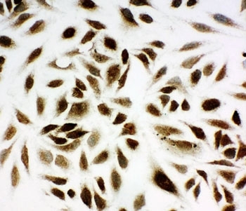 ICC testing of NM23 antibody and HeLa cells