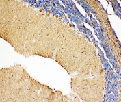 IHC-P: NME2 antibody testing of rat cerebellum tissue