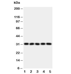 Western blot testing of LOX-1 antibody and Lane 1: HeLa; 2: SMMC-7721; 3: U87; 4: U937; 5: K562 lysate. Predicted size: pro-form 35-50KD, mature form ~31KD