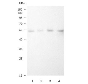 Western blot testing of human 1) prostatic carcinoma tissue (PCT) lysate, 2) cervical carcinoma tissue (CCAT) lysate, 3) gallbladder carcinoma tissue (GBCT) lysate and 4) intrahepatic cholangiocarcinom paracancerous tissue (ICCP) lysate with LOX-1 antibody. Predicted molecular weight: pro-form 35-50 kDa, mature f