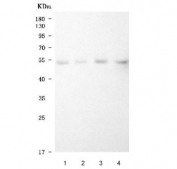 Western blot testing of human 1) prostatic carcinoma tissue (PCT) lysate, 2) cervical carcinoma tissue (CCAT) lysate, 3) gallbladder carcinoma tissue (GBCT) lysate and 4) intrahepatic cholangiocarcinom paracancerous tissue (ICCP) lysate with LOX-1 antibody. Predicted molecular weight: pro-form 35-50 kDa, mature form ~31 kDa.
