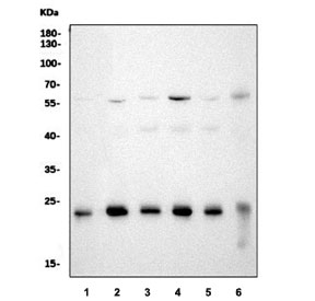 Western blot testing of 1) human HeLa, 2) human MCF7, 3) rat brain, 4) rat liver, 5) mouse brain and 6) mouse liver tissue lysate with Peroxiredoxin 3 antibody. Predicted molecular weight ~28 kDa.