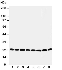 Western blot testing of Peroxiredoxin 5 antibody and Lane 1: rat brain; 2: (r) lung; 3: (r) liver; 4: (r) kidney; 5: human HeLa; 6: (h) 293T; 7: (h) MCF-7; 8: (h) A549 cell lysate. Expected size: ~22KD