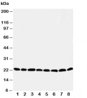 Western blot testing of Peroxiredoxin 5 antibody and Lane 1:  rat brain;  2: (r) lung;  3: (r) liver;  4: (r) kidney;  5: human HeLa;  6: (h) 293T;  7: (h) MCF-7;  8: (h) A549 cell lysate.  Expected size: ~22KD