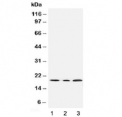 Western blot testing of SDHC antibody and Lane 1:  rat liver;  2: mouse liver;  3: human HeLa cell lysate