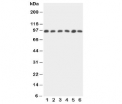 Western blot testing of STAT5b antibody and Lane 1:  rat intestine;  2: rat kidney; and human samples 3: HeLa;  4: A549;  5: MM231;  6: COLO320 cell lysate.  Predicted molecular weight ~90 kDa.