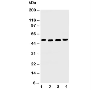 Western blot testing of TRAIL R2 antibody and Lane 1: HeLa; 2: MM231; 3: SGC; 4: HT1080 cell lysate~