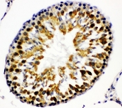 IHC-P: Beta Arrestin 2 antibody testing of rat testis tissue. HIER: steamed with pH6 citrate buffer.