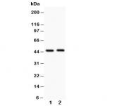 Western blot testing of Beta Arrestin 2 antibody and Lane 1:  human HeLa;  2: rat skeletal muscle. Predicted molecular weight: 44~47kDa (isoforms 1-5).