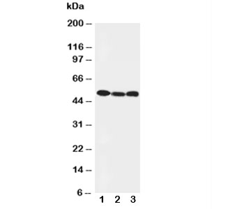 Western blot testing of Beclin 1 antibody and Lane 1: HeLa; 2: SW620; 3: PANC cell lysate. Predicted and Observed size: 49KD
