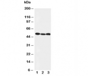 Western blot testing of Beclin 1 antibody and Lane 1:  HeLa;  2: SW620;  3: PANC cell lysate.  Predicted and Observed size: 49KD