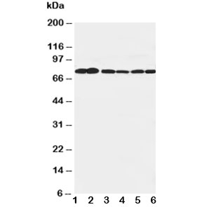 Western blot testing of B Raf antibody and Lane 1: rat brain; 2: rat testis; 3: rat liver; 4: (h) SW620; 5: (h) COLO320; 6: (r) PC-12 cell lysate