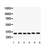 Western blot testing of 1) rat heart, 2) rat liver, 3) rat thymus, 4) MCF7, 5) SMMC and 6) HT1080 lysate with Caspase-3 antibody. Predicted molecular weight ~31 kDa.