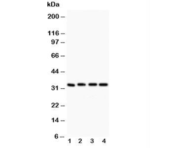 Western blot testing of Caspase-3 antibody (0.5ug/ml) and Lane 1: rat liver; 2: MCF-7; 3: SMMC-7721; 4: HT1080 lysate~