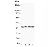 Western blot testing of Caspase-3 antibody (0.5ug/ml) and Lane 1:  rat liver; 2: MCF-7; 3: SMMC-7721;  4: HT1080 lysate. Predicted molecular weight ~31 kDa.