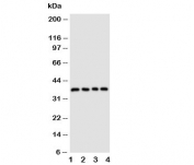 Western blot testing of CD1d antibody and Lane 1:  COLO320;  2: HeLa;  3: HT1080;  4: Jurkat cell lysate