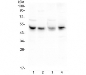 Western blot testing of 1) rat liver, 2) rat heart, 3) mouse liver and 4) mouse HEPA1-6 lysate with CAR antibody at 0.5ug/ml. Expected molecular weight: 40-50 kDa.