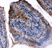 IHC staining of FFPE mouse intestine tissue with FABP5 antibody. HIER: boil tissue sections in pH8 EDTA for 20 min and allow to cool before testing.