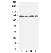 Western blot testing of FES antibody and Lane 1:  HeLa;  2: 293T;  3: SKOV;  4: A549 lysate.  Predicted molecular weight ~93 kDa.