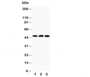 Western blot testing of HYAL3 antibody and Lane 1:  22RV;  2: HeLa;  3: V20S cell lysate.  Expected size: ~47KD