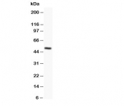 Western blot testing of Orai1 antibody and SKOV lysate;  Predicted molecular weight ~ 33 kDa;  Observed size 45~50 kDa due to glycosylation