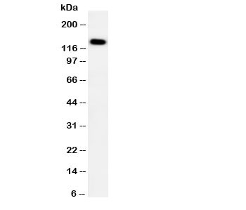 Western blot testing of PTCH2 antibody and HeLa cell lysate. Expected size: ~130KD
