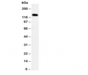 Western blot testing of PTCH2 antibody and human HeLa cell lysate.  Expected molecular weight ~130 kDa.