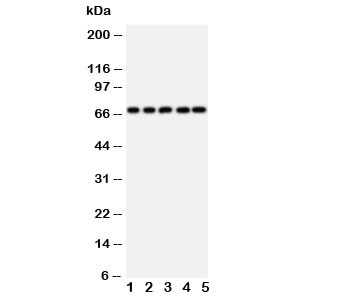 Western blot testing of SHP2 antibody and rat samples 1: heart; 2: skeletal muscle; 3: brain; and human samples 4: HeLa; 5: A549 cell lysate. Expected size ~68KD~