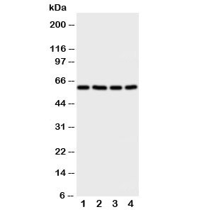 Western blot testing of RIP2 antibody and Lane 1: A549; 2: HeLa; 3: PANC; 4: COLO320 cell lysate. Predicted size: ~61KD
