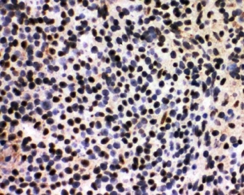 IHC staining of frozen rat spleen tissue with Splicing factor 1 antibody.