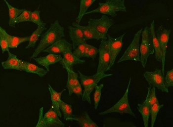 Immunofluorescent staining of FFPE human U-87 MG cells with Splicing factor 1 antibody (red). HIER: steam section in pH6 citrate buffer for 20 min.