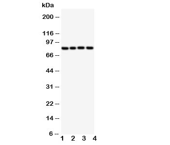 Western blot testing of Sp4 antibody and Lane 1: rat spleen; and human samples 2: SGC; 3: HeLa; 4: Jurkat; 5: A549 cell lysate