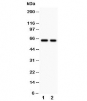 Western blot testing of TGFBR2 antibody and Lane 1:  HEPG2;  2: COLO320. Expected molecular weight ~65 kDa, routinely observed at 65-80 kDa.
