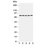 Western blot testing of ABCG1 antibody and Lane 1:  U87;  2: SMMC-7721;  3: HeLa;  4: COLO320;  5: MCF-7 cell lysate.  Predicted molecular weight: 75~90KD