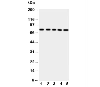 Western blot testing of ABCG2 antibody and Lane 1: HeLa; 2: SW620; 3: MCF-7; 4: SKOV; 5: Jurkat cell lysate
