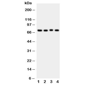 Western blot testing of ABCG2 antibody and Lane 1: rat liver; 2: rat spleen; 3: rat kidney; 4: mouse spleen tissue lysate